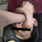 M男の口の中に生足を突っ込む【歯科助手様の一年履いたナースサンダルとパンストとナマ足で入れ歯患者の歯茎検査】