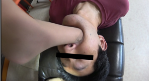 M男の口の中に生足を突っ込む【歯科助手様の一年履いたナースサンダルとパンストとナマ足で入れ歯患者の歯茎検査】