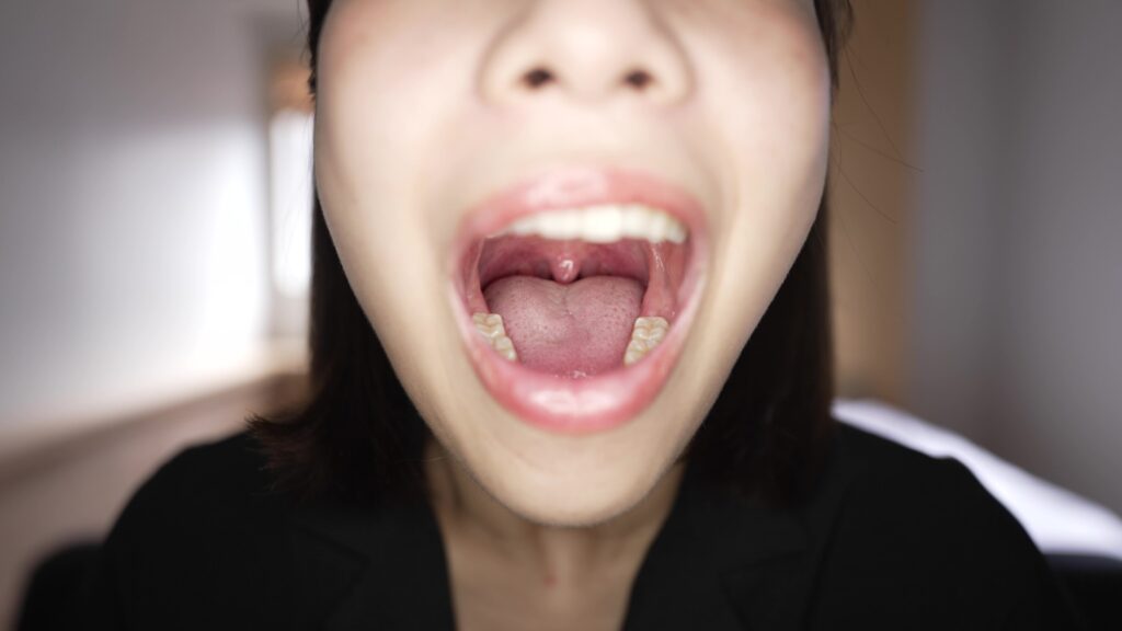 湊波流口腔