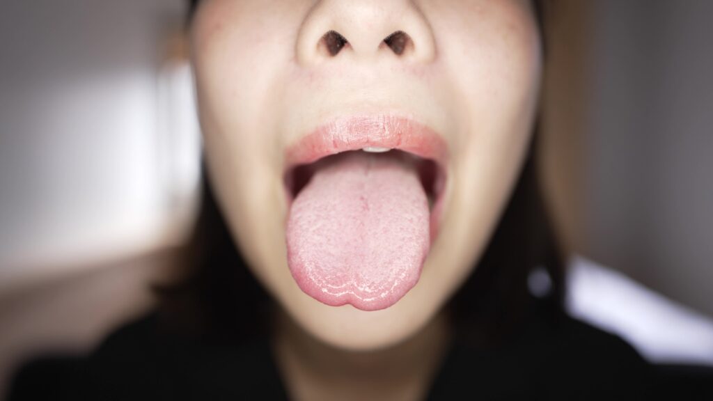 湊波流口腔